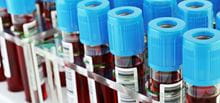 Blood vials in rack